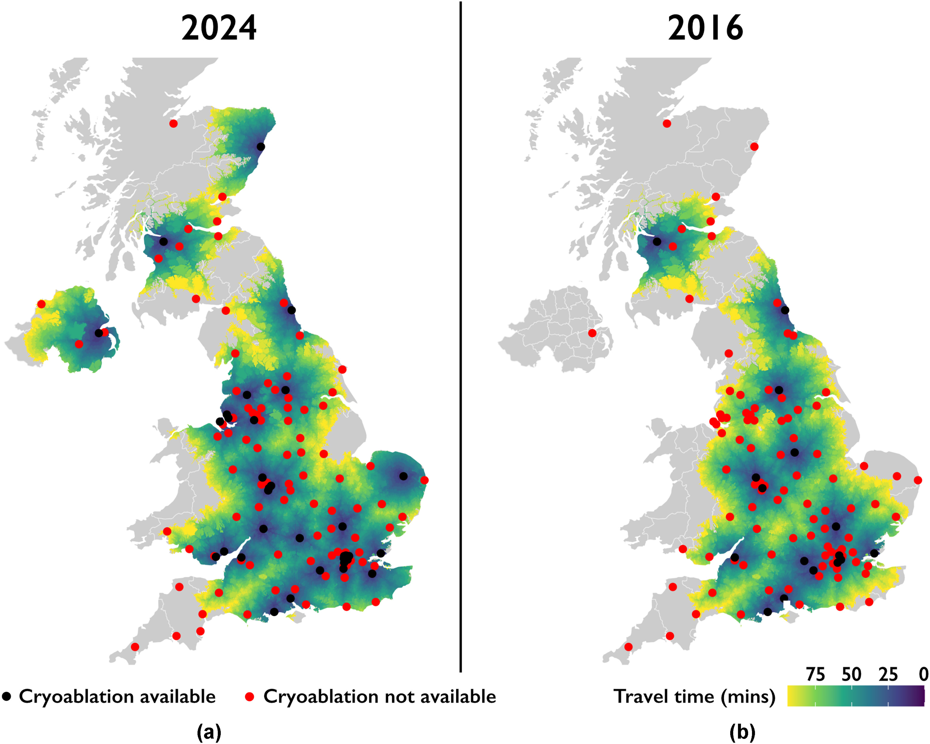Geographical distribution of cryoablation services in the UK